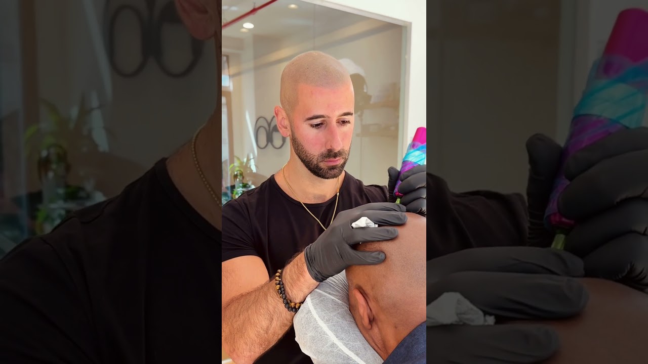 Scalp Micropigmentation in Action ⚡️