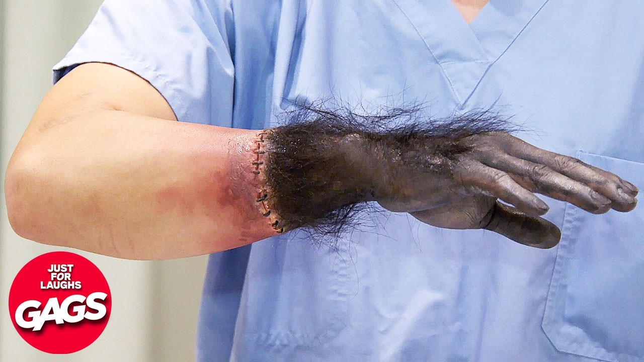 Hand Transplant Goes Horribly Wrong | Just For Laughs Gags