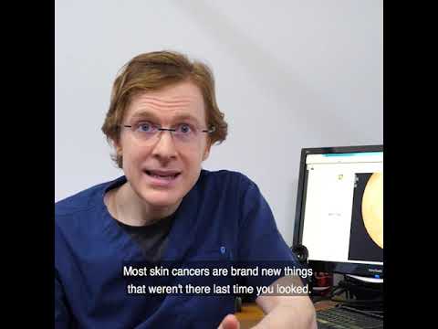 Myth Bust: Not All Moles Are Skin Cancers 🩺