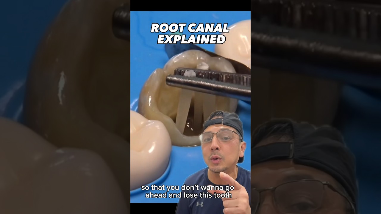 Save Your Tooth with a Root Canal & Crown 🦷