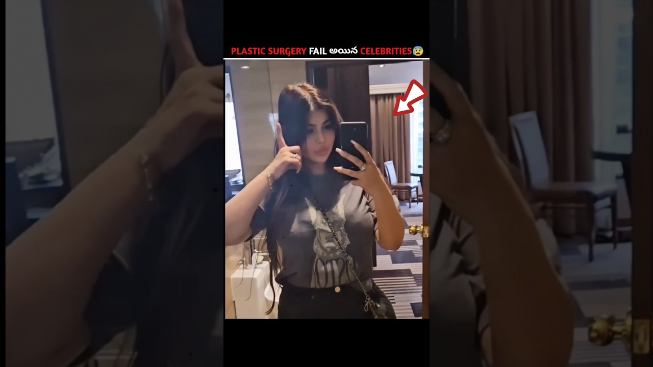 Celebrities & Their Plastic Surgery Fails 😰