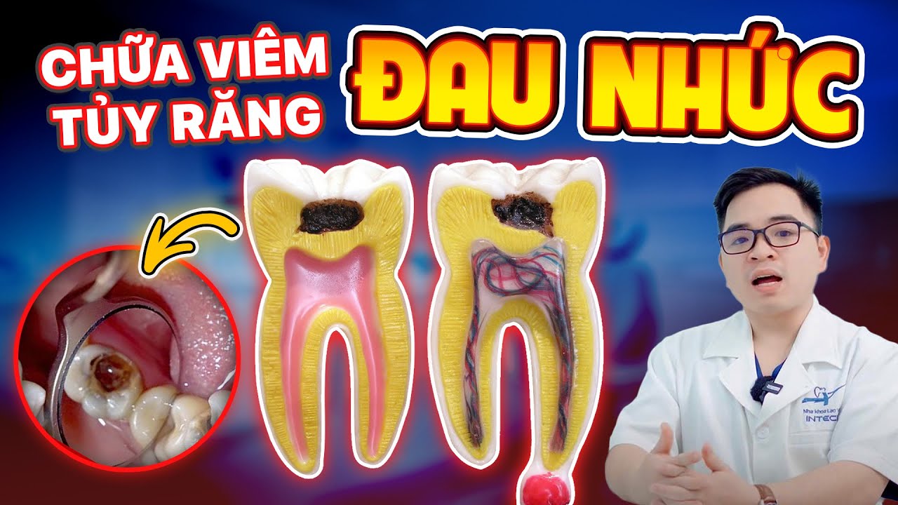 Chữa Viêm Tủy Răng Hiệu Quả Chỉ Với 2 Phương Pháp