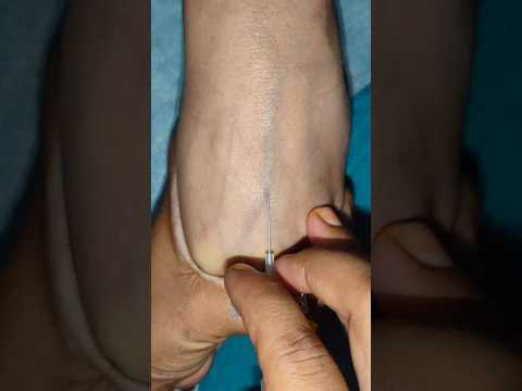 CANNULATION PRACTICE  #neet #aims #mbbs #medical #youtubeshorts #viral #shortvideo#trending