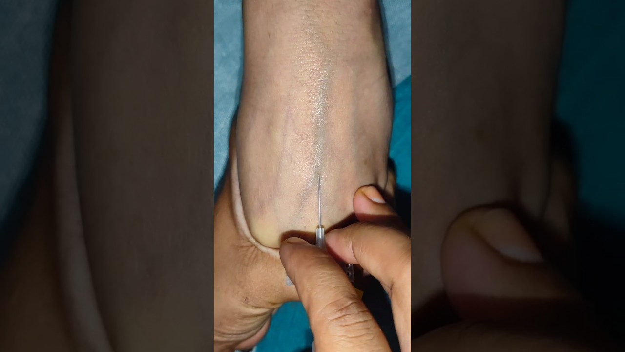 Master Cannulation Skills for NEET & AIMS Success 🩺