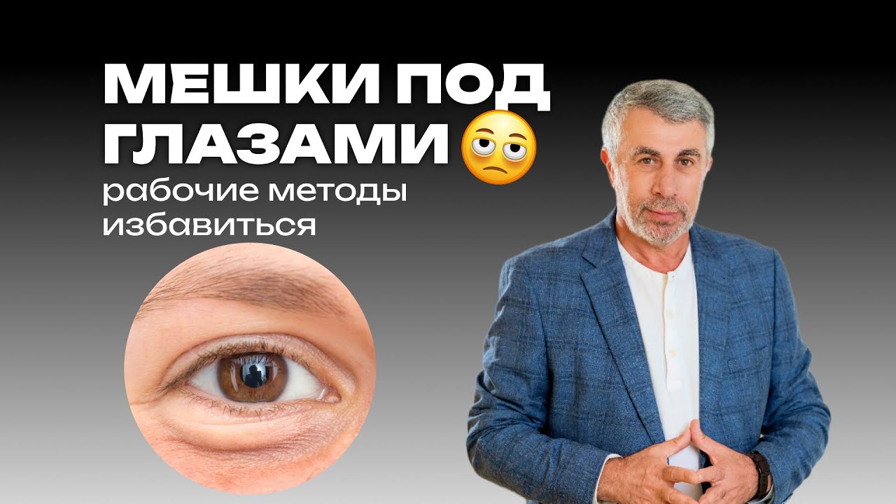 Как избавиться от мешков под глазами 👁️