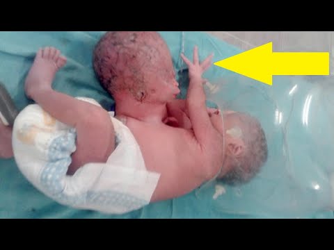 The Most Powerful 6 Stories Heartwarming About Baby . #Wonderbot #Did_you_know #Viral_Story