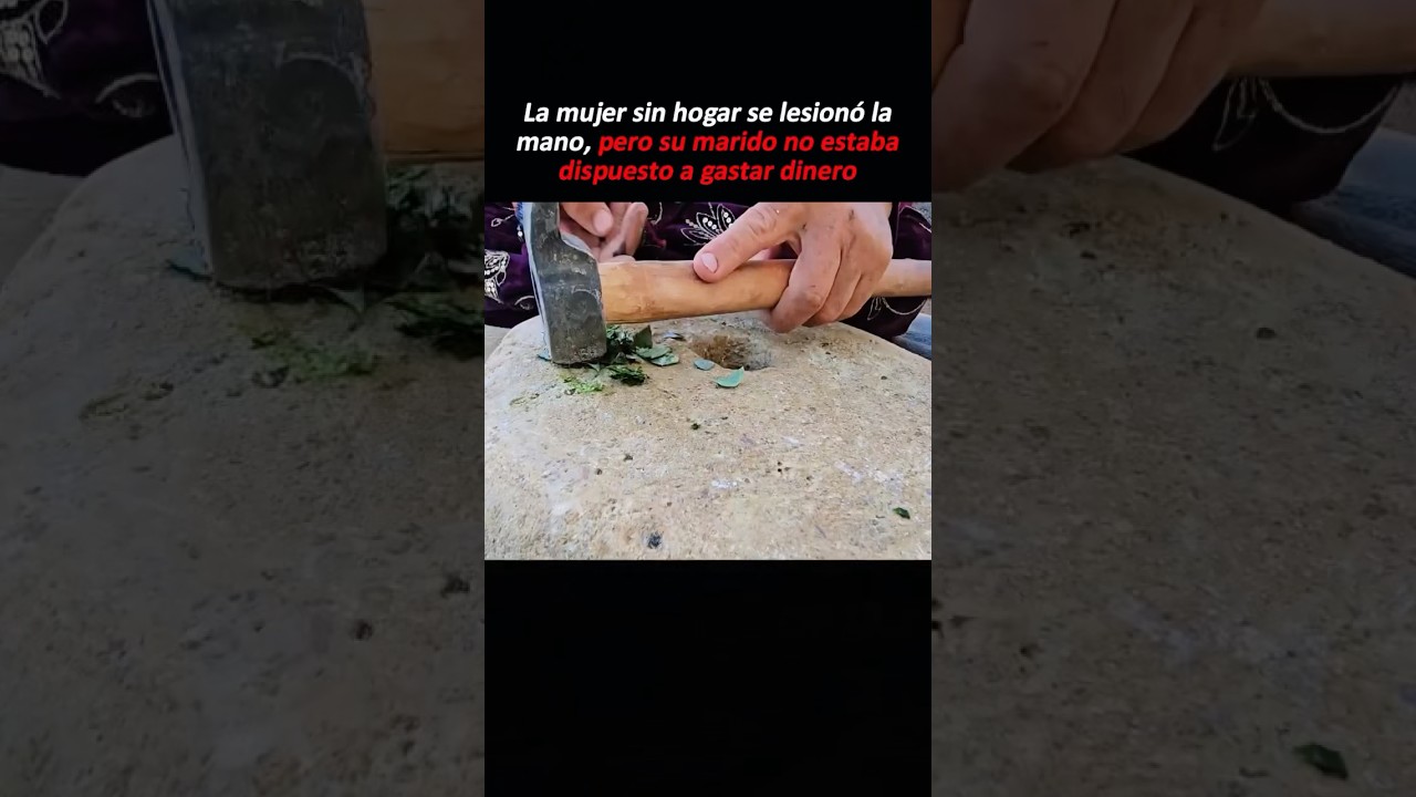 La mujer sin hogar se lesionó la mano, pero su marido no estaba dispuesto a gastar dinero #youtube