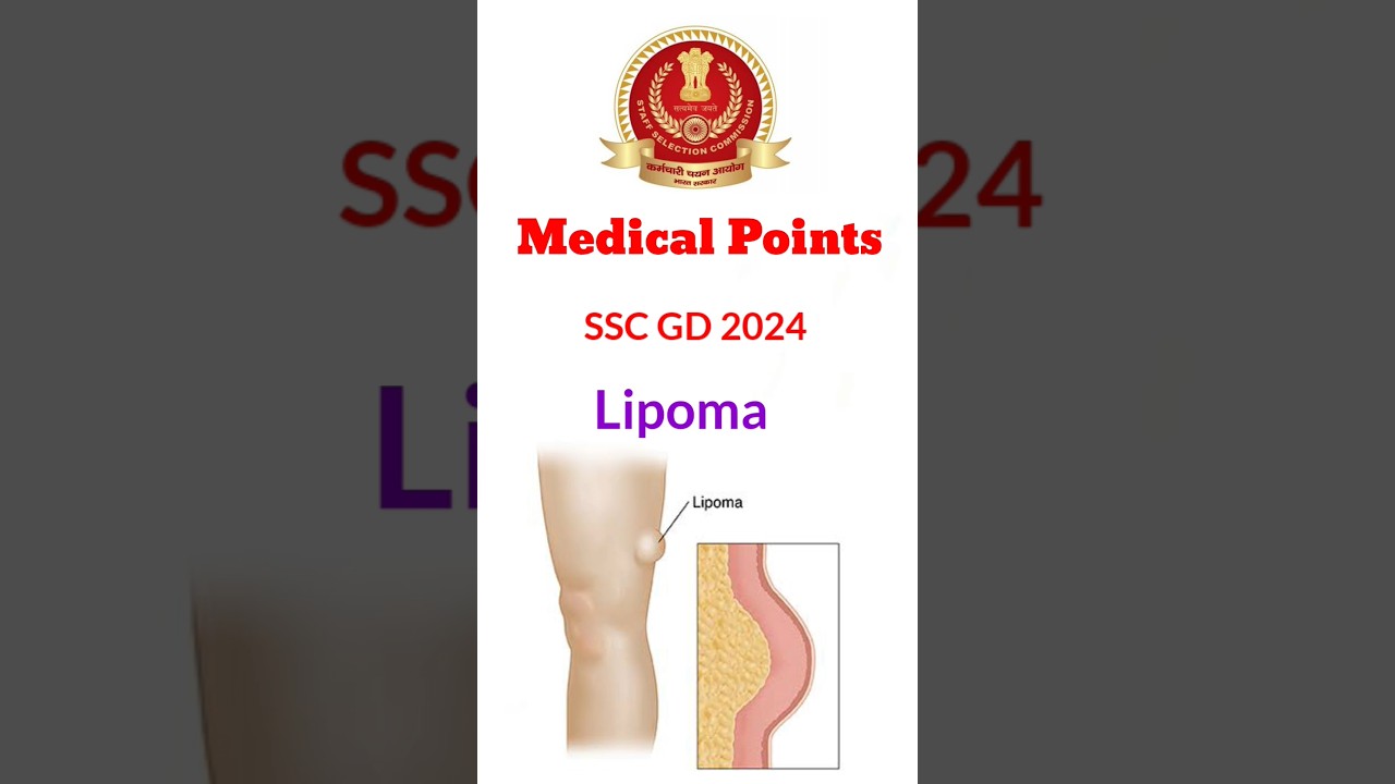 SSC GD 2024 Unfit Points Explained 😢