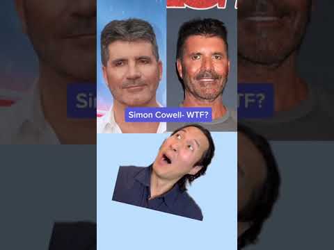 Stunning Male Plastic Surgery Transformations