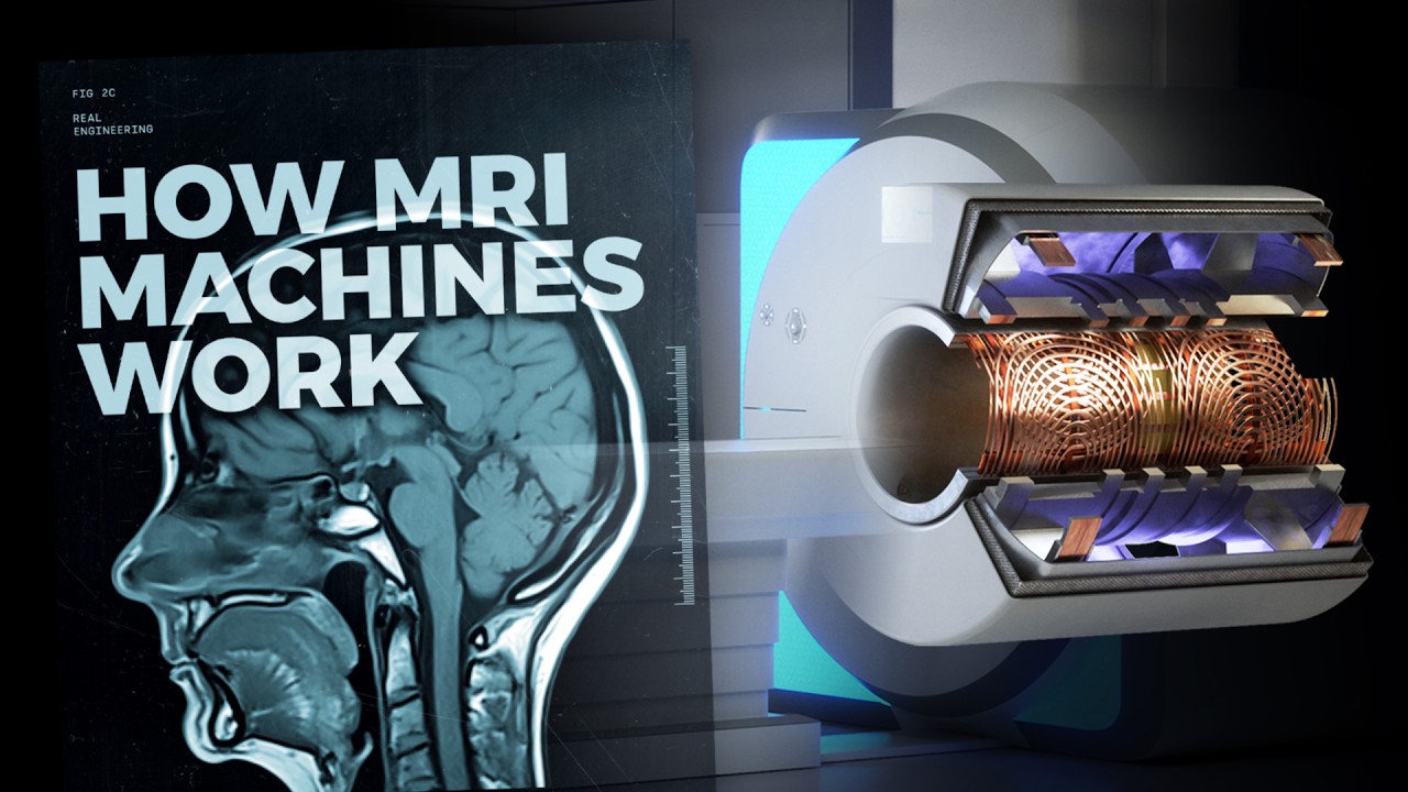 Discover the Amazing Engineering Behind MRI Machines 🧠
