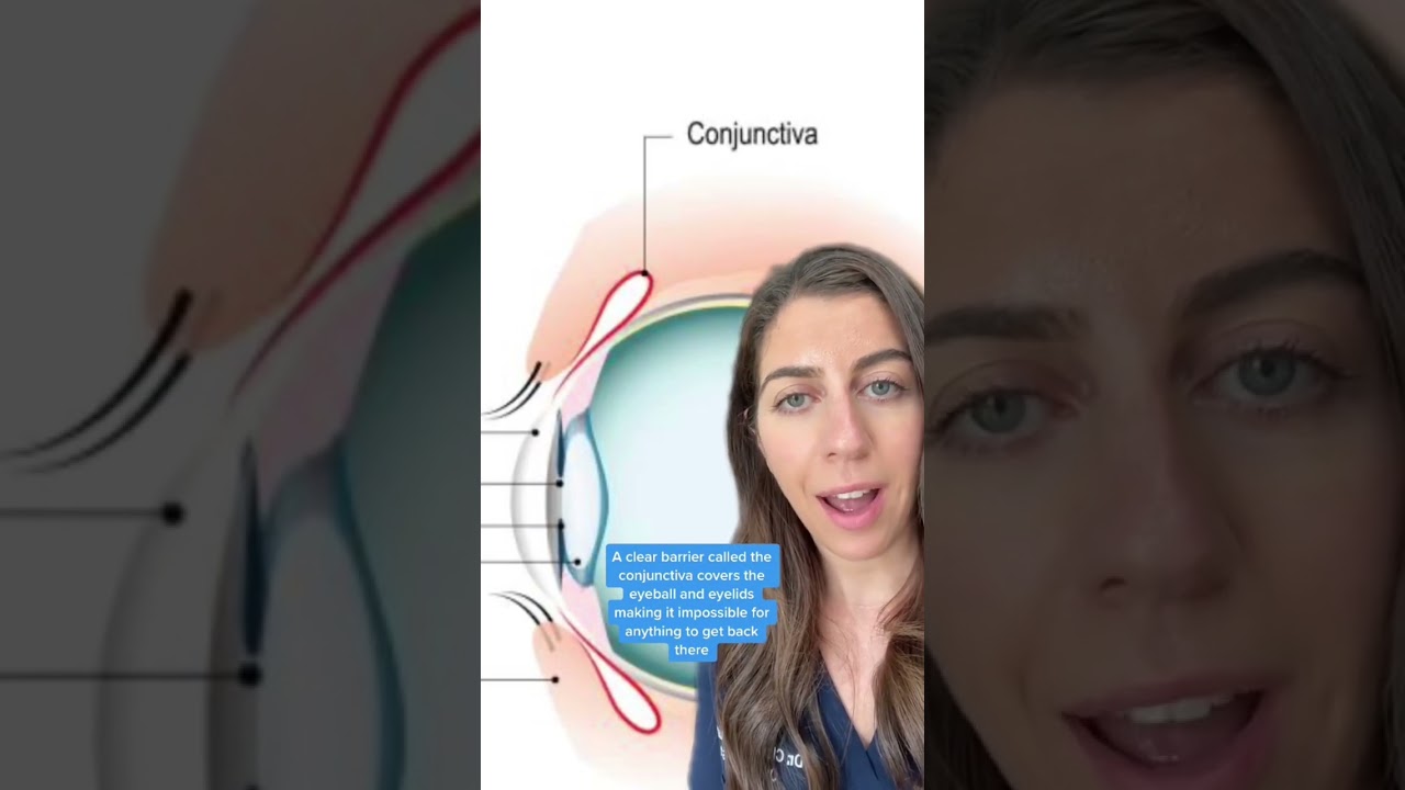 Why Contact Lenses Donโt Get Stuck Behind Your Eye ๐๏ธ