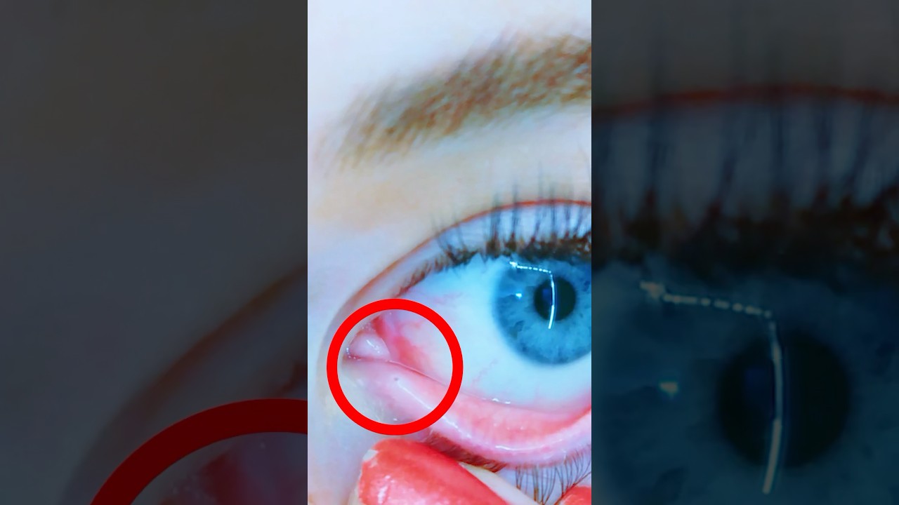 Sabre Spots Something Unusual in Her Eye 👁️