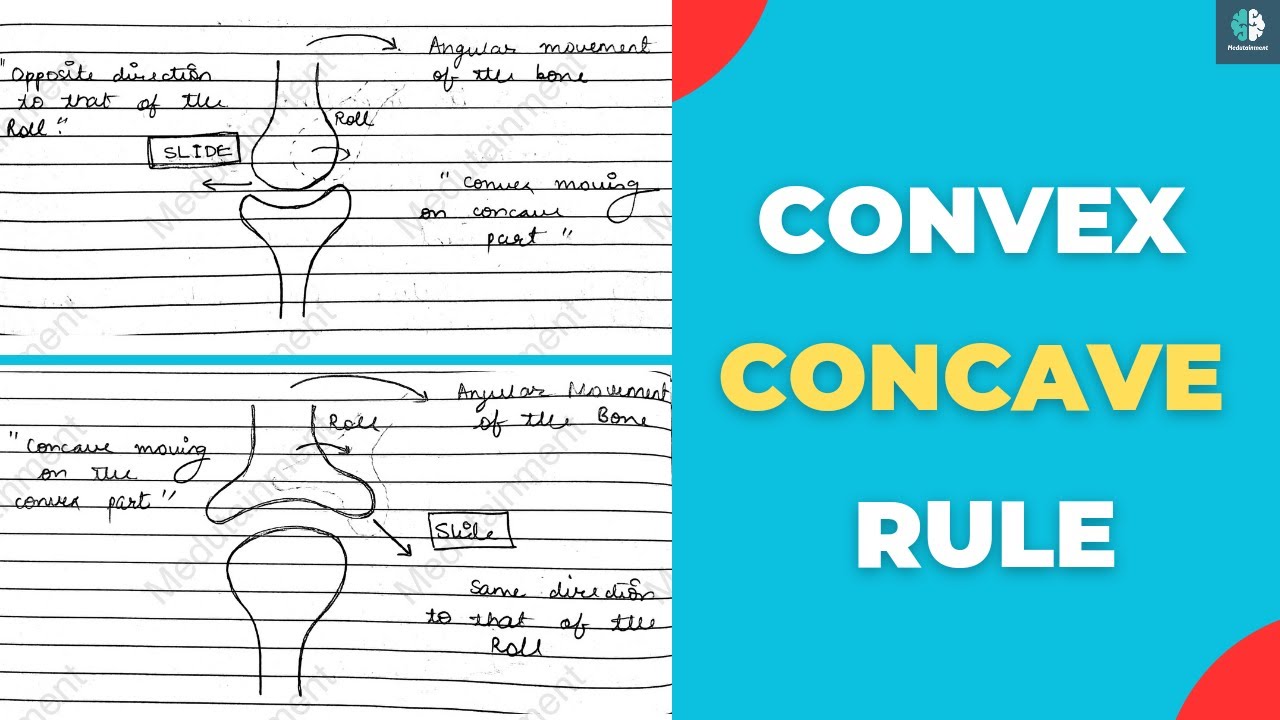 Convex-Concave Rule in Biomechanics & Physiotherapy 🦵