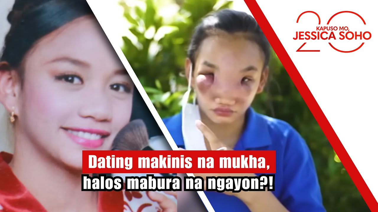 Dating Makinis na Mukha ni Mary Ann, Ngayon ay Halos Mabura na! 😢 | Kapuso Mo, Jessica Soho