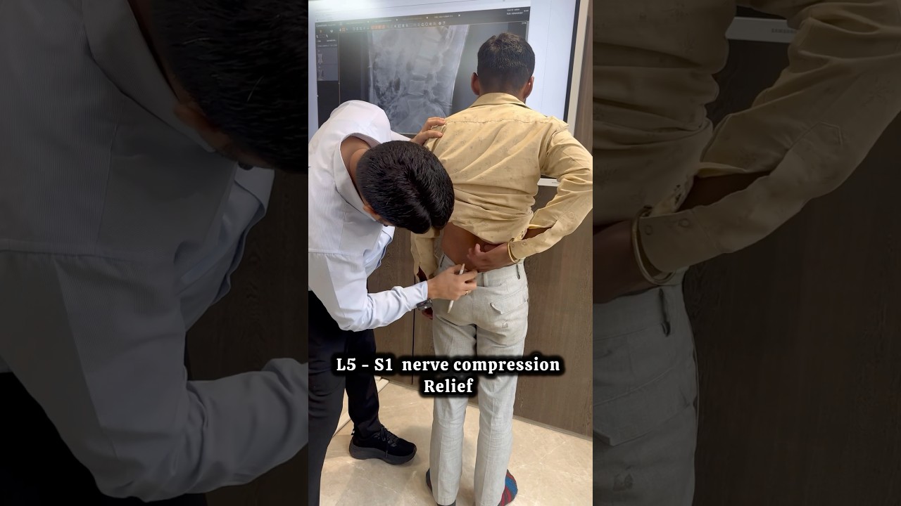 Advanced Chiropractic Treatment for L5-S1 Nerve Compression by Dr. Harish Grover