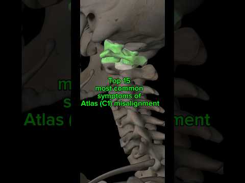 What are the MOST COMMON symptoms of ATLAS (C1) Misalignment? | Upper Cervical Care