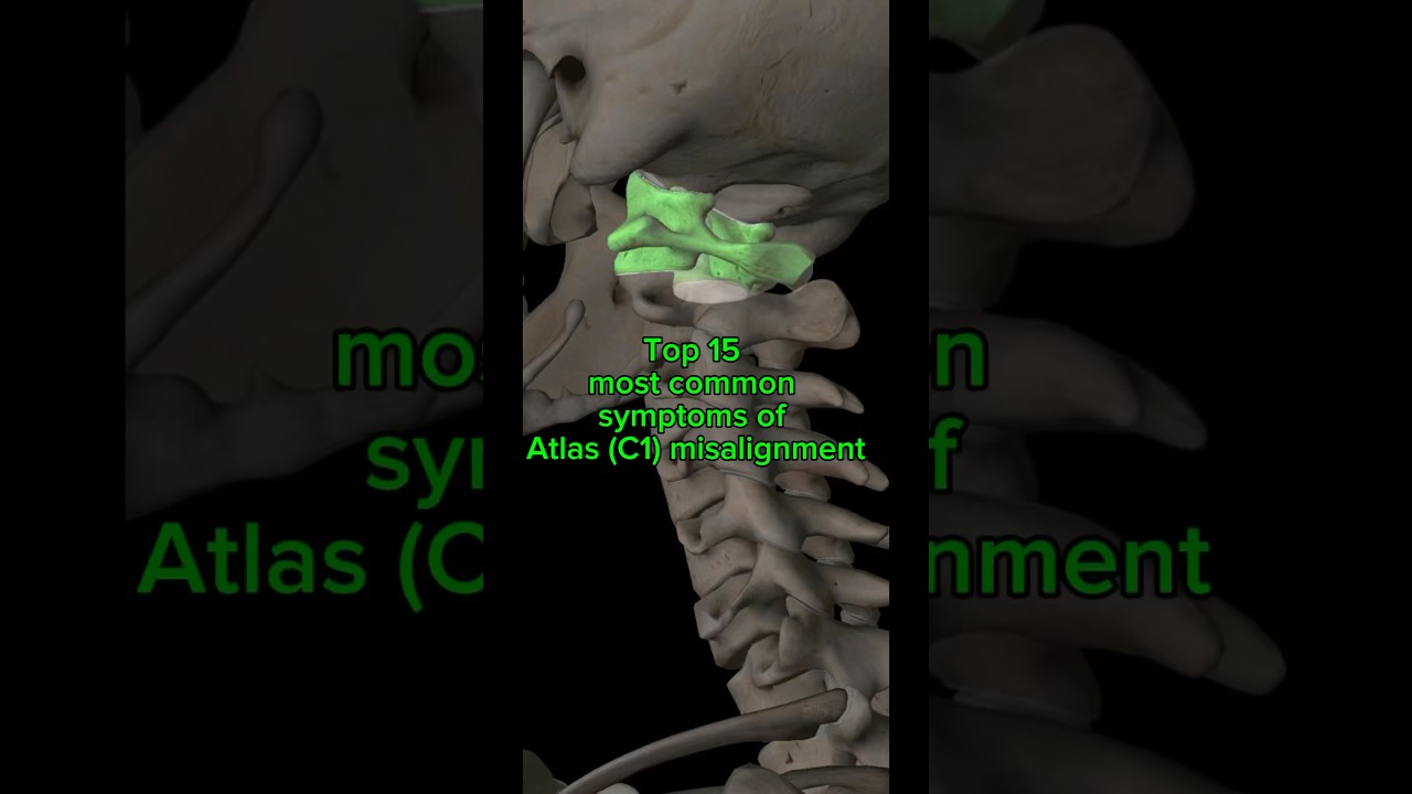 Most Common Symptoms of Atlas (C1) Misalignment | Upper Cervical Care
