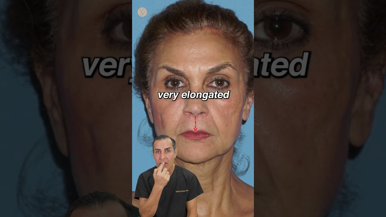 Stunning 60-Year-Old Rejuvenation Transformation ✨