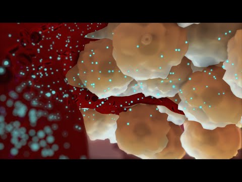 Understanding Type 2 Diabetes 🩺 | Nucleus Health
