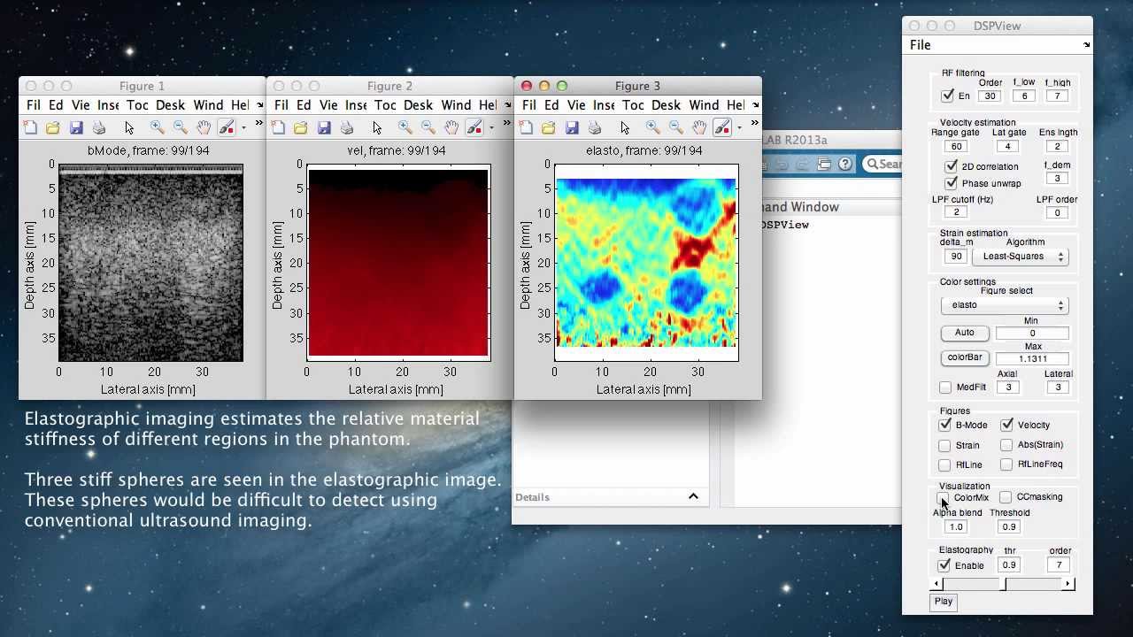 DSPView: Ultrasound & Image Processing in MATLAB 🖥️