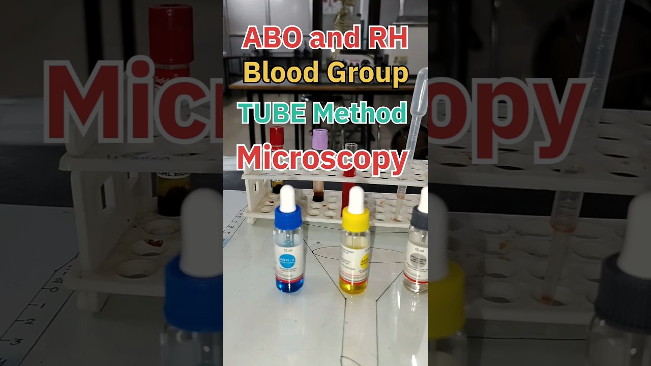Tube Method Blood Group Testing Explained
