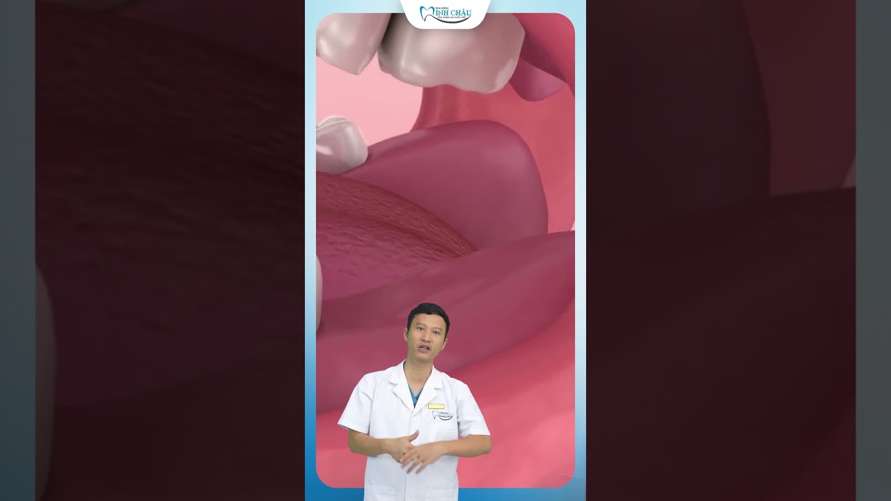 Viêm Lợi Trùm Răng Khôn | Bác Sĩ Yên 🦷
