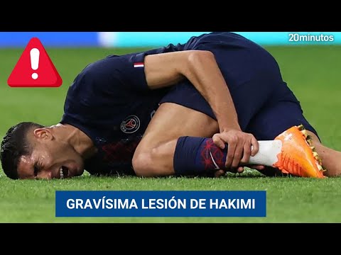 20minutos