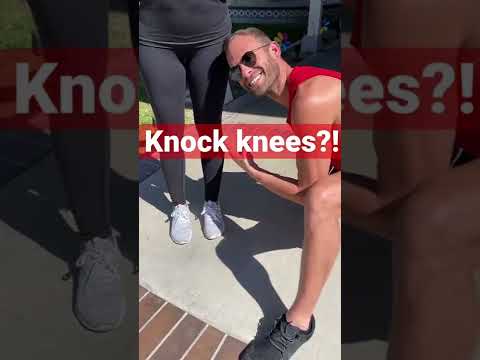How To Fix Your Knock Knees From Home… Grab a Pillow! #knockknees #kneepain #walking