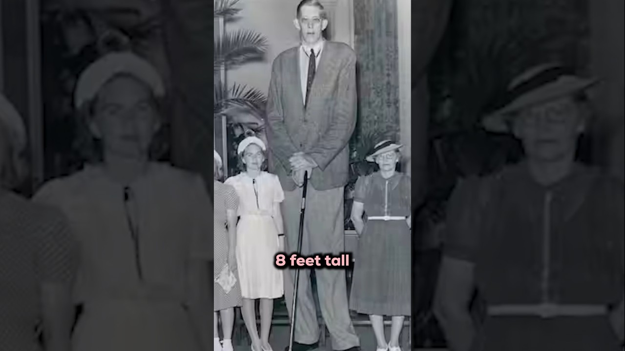 8 Feet Tall: Excess Growth Hormone 🧬