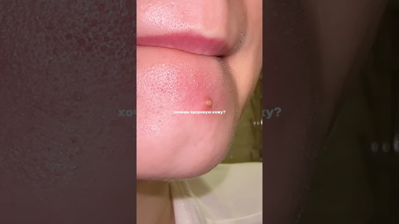 Здоровая кожа: советы и уход 💗