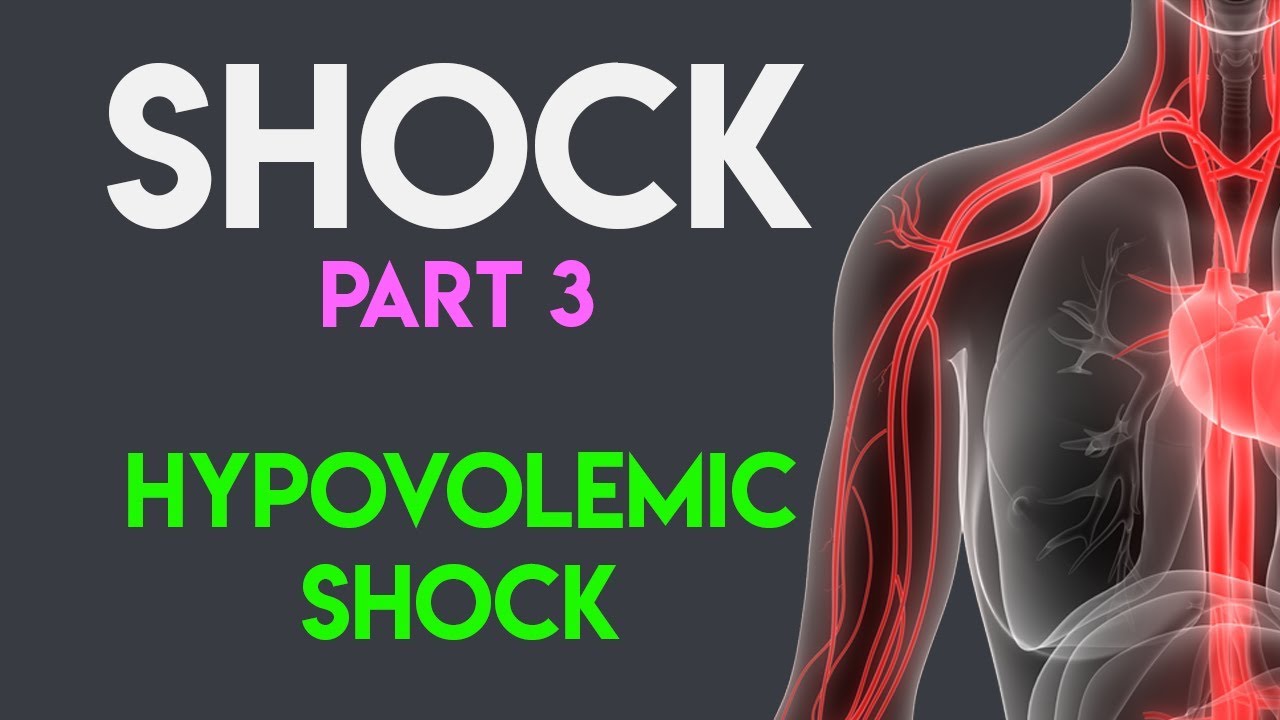 Hypovolemic Shock Explained | ICU Advantage 🎓
