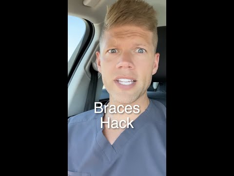 BRACES HACK!! How To Put Rubber Bands On Braces 😬