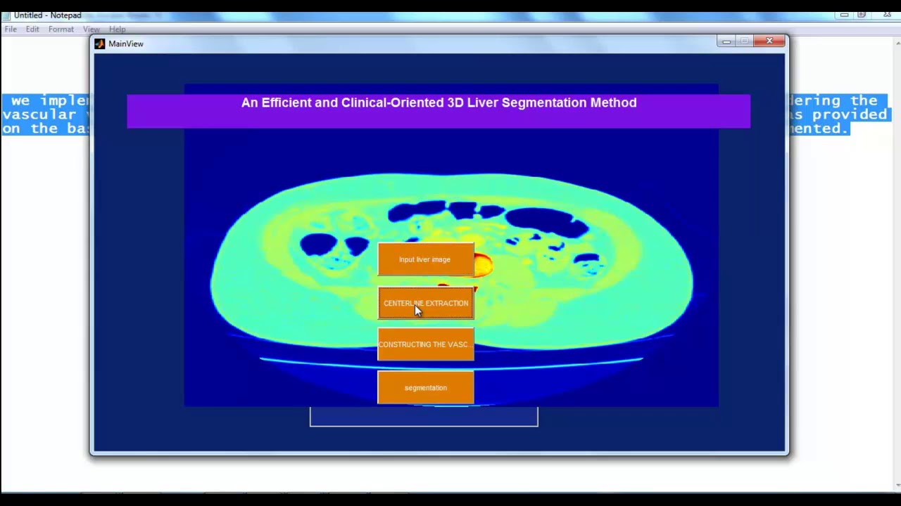 Mini Projects Using Matlab | Mini Thesis Using Matlab | Mini Projects Code Using Matlab