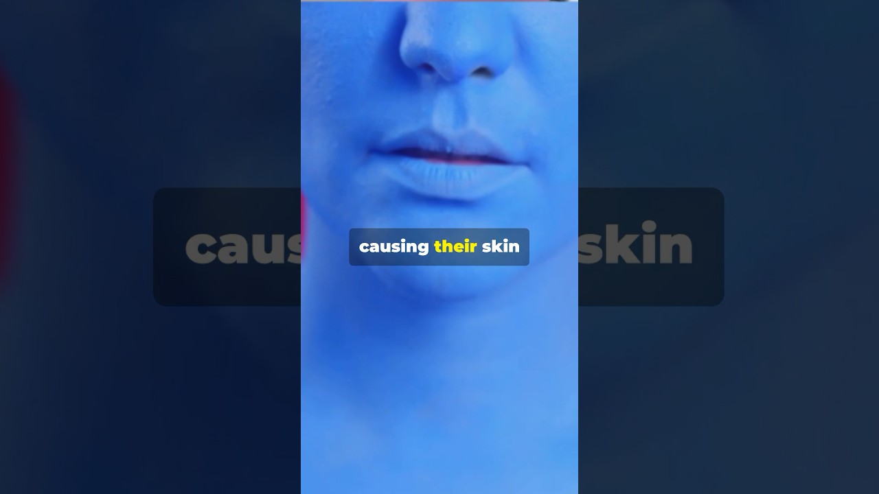 The Blue Family of Kentucky: Unraveling a Genetic Mystery 🧬