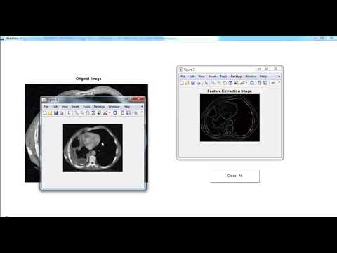 Biomedical Image Processing Projects & Thesis