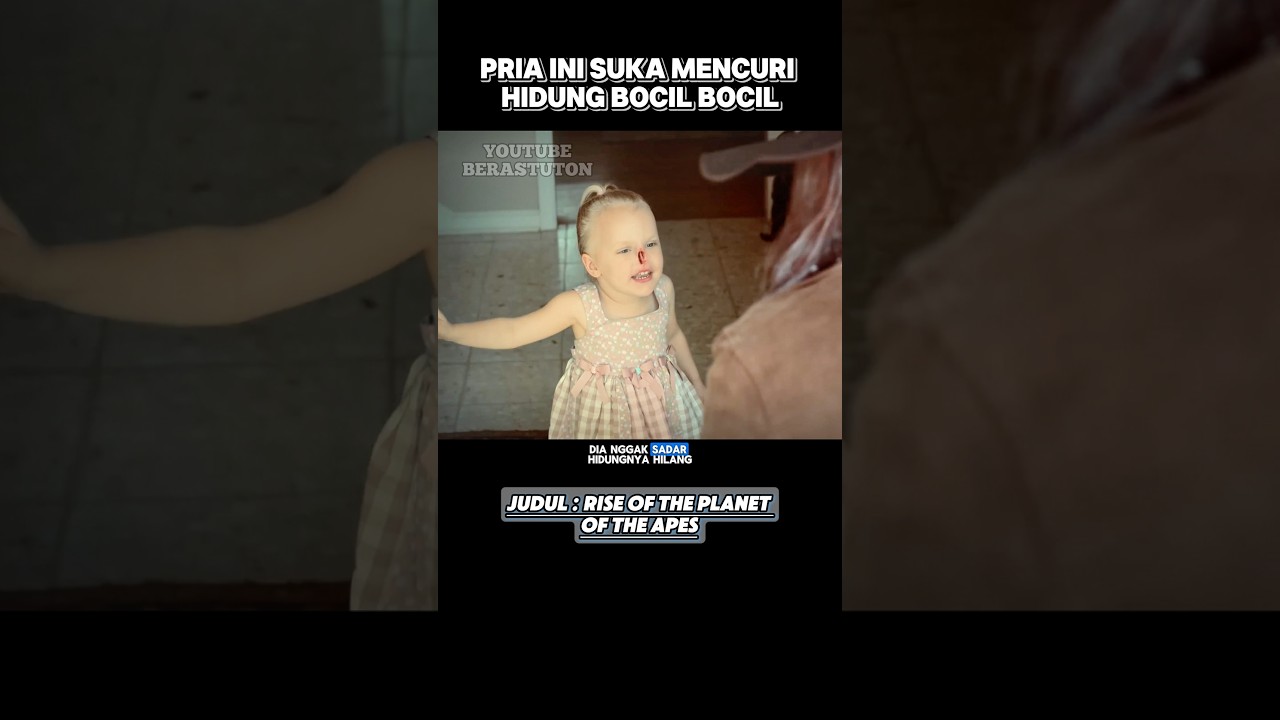 Bocil Ini Diambil Hidungnya π