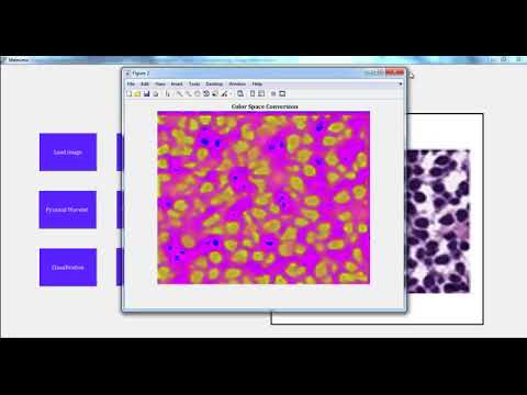Final Year Ece Projects Based on Image Processing | Final Year Ece Thesis Based on Image Processing
