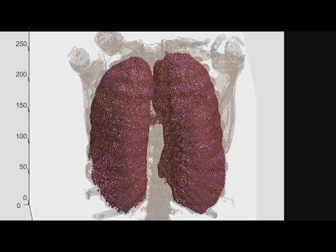 3D Volumetric Image Processing Demo - MATLAB Video
