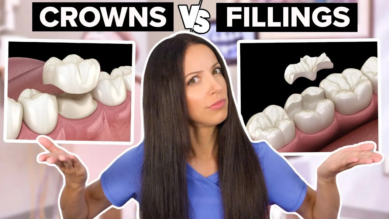 Dental Crowns vs Fillings: Key Differences 🦷