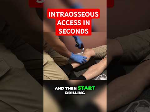 Live demo: Intraosseous access (EZ IO)