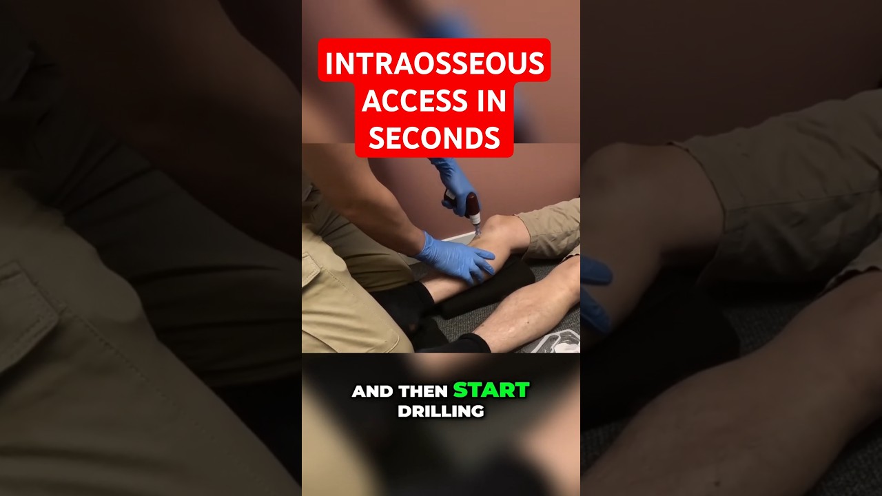 Live Demo: Mastering Intraosseous Access (EZ-IO) for Emergency Situations 🩻