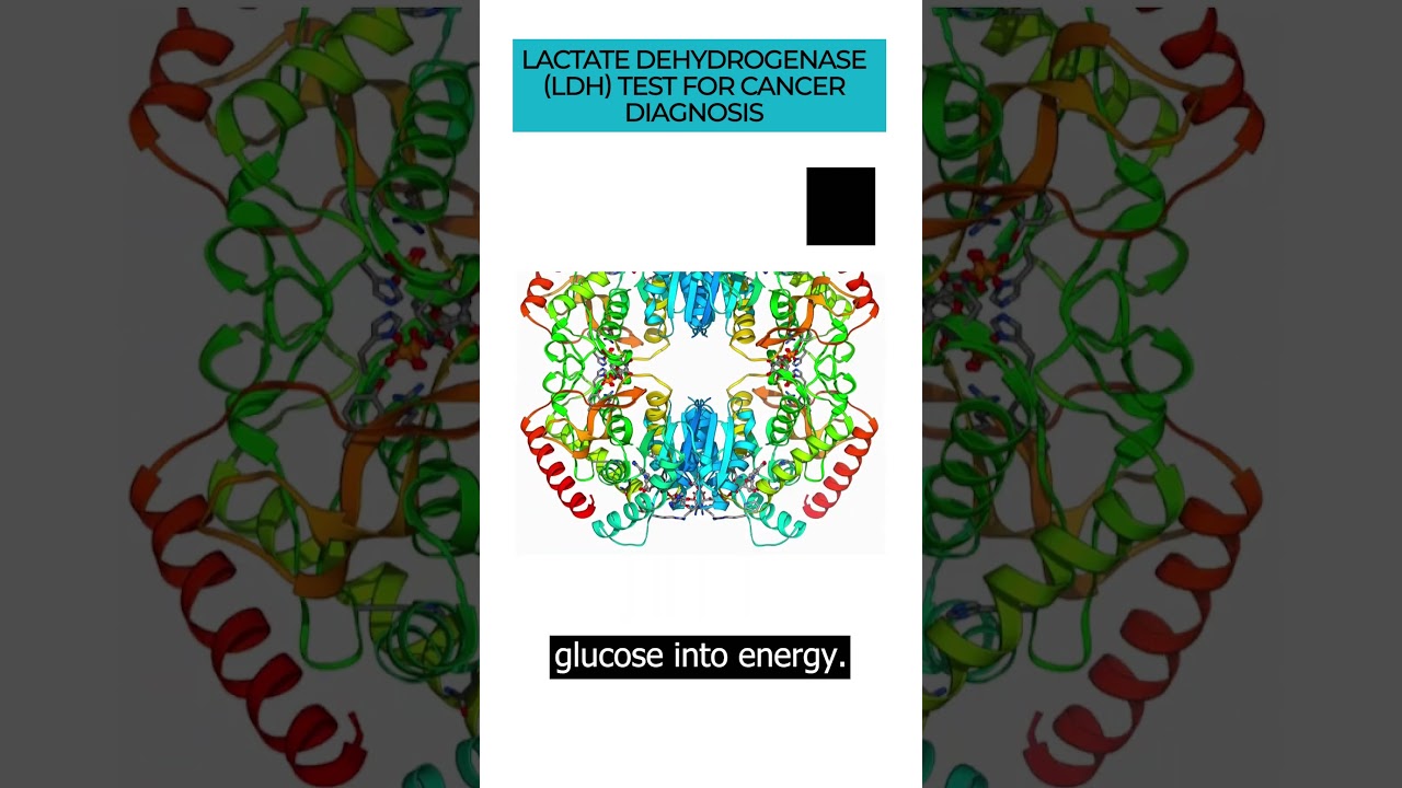 LDH Test: Key in Cancer Diagnosis & Monitoring 🩺
