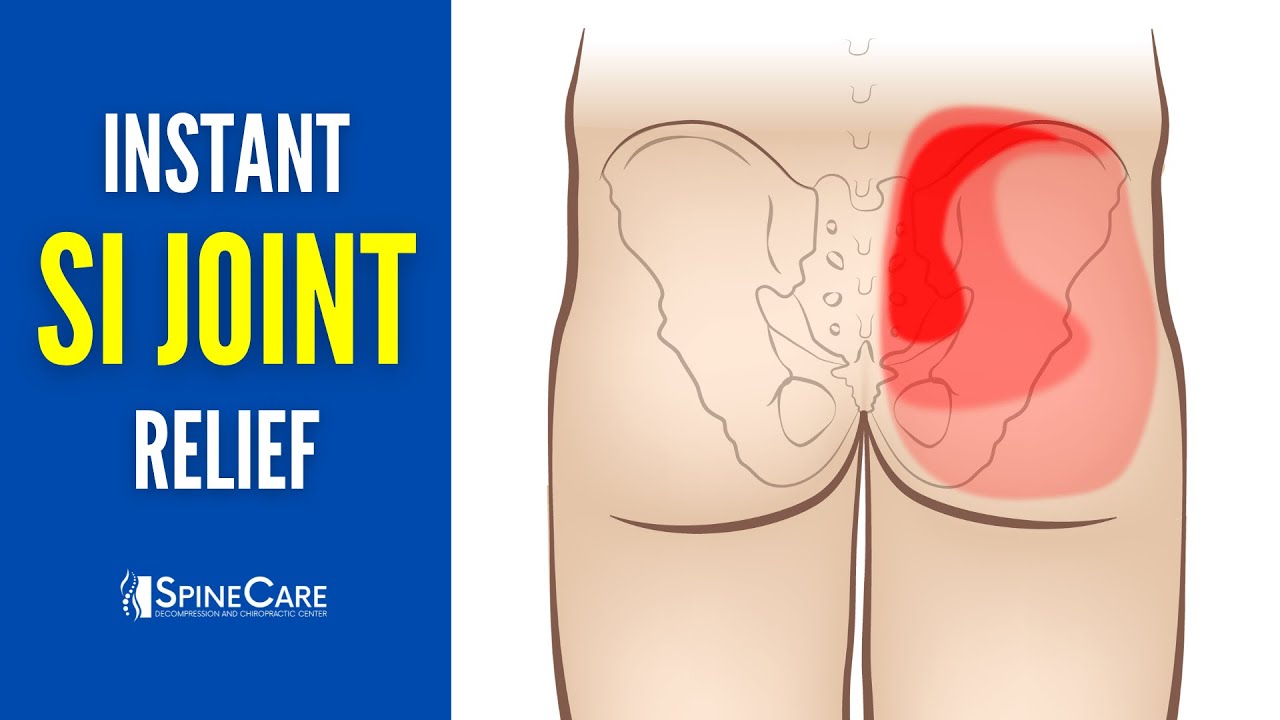 Quick Relief for SI Joint Pain in 30 Seconds 🕒