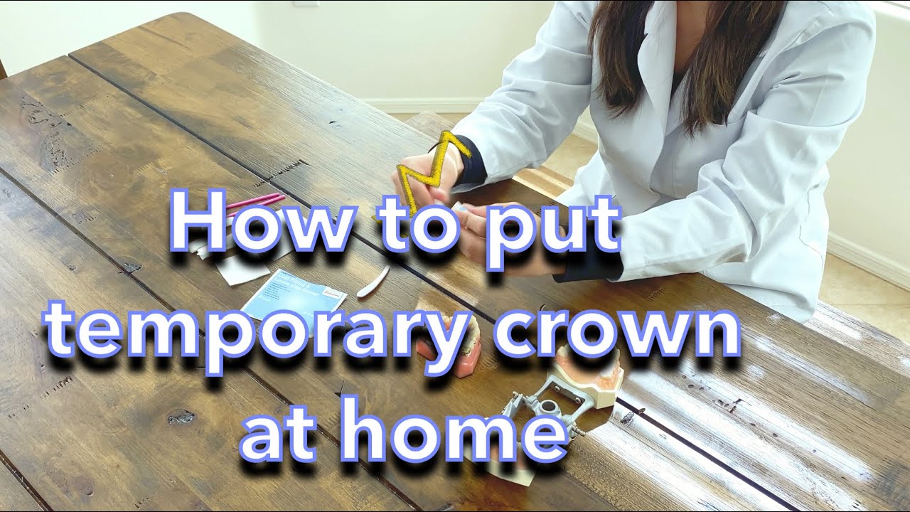 How to Reattach a Temporary Crown at Home 🦷