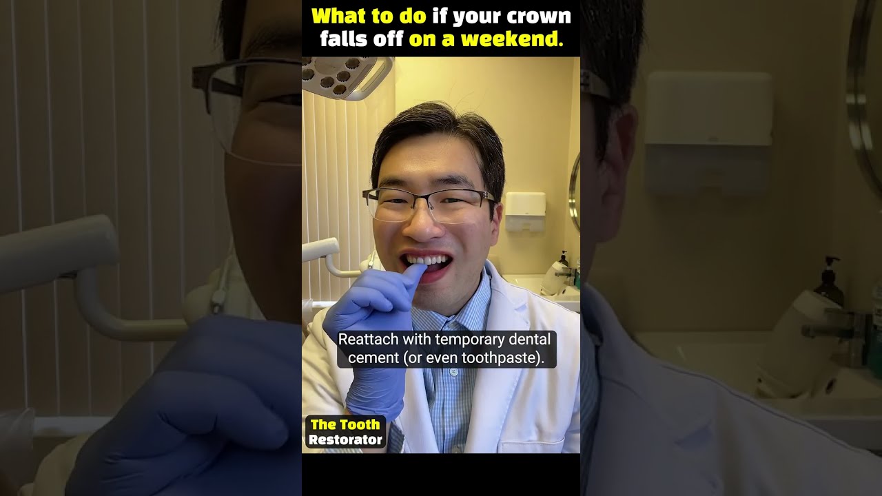 Front Tooth Crown Fell Off? Here's What to Do 🦷