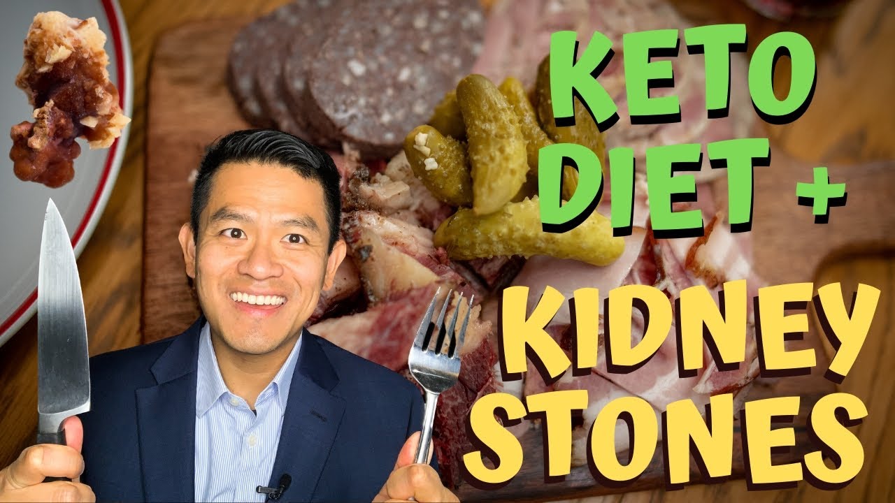 Keto Diet & Kidney Stones: Causes Explained 🩺