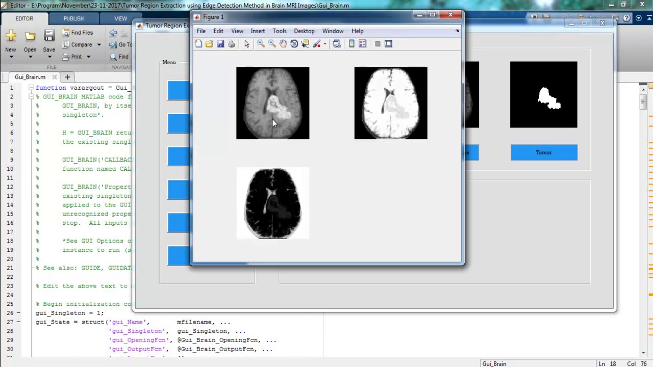 Digital Image Processing Mini Projects & Thesis ๐ธ