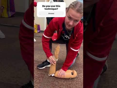 What is your favorite reduction technique on Elbow Dislocation? #orthopedic #emergencymedicine