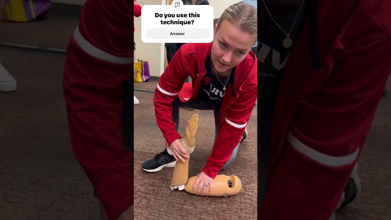 Effective Face-Up Technique for Elbow Dislocation Reduction 🩺