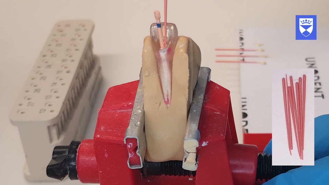 Single Rooted Tooth Endodontic Treatment: Part 6 🦷